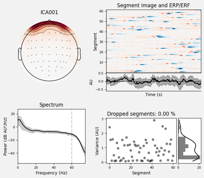 _images/train_network_eeg_1_528.png