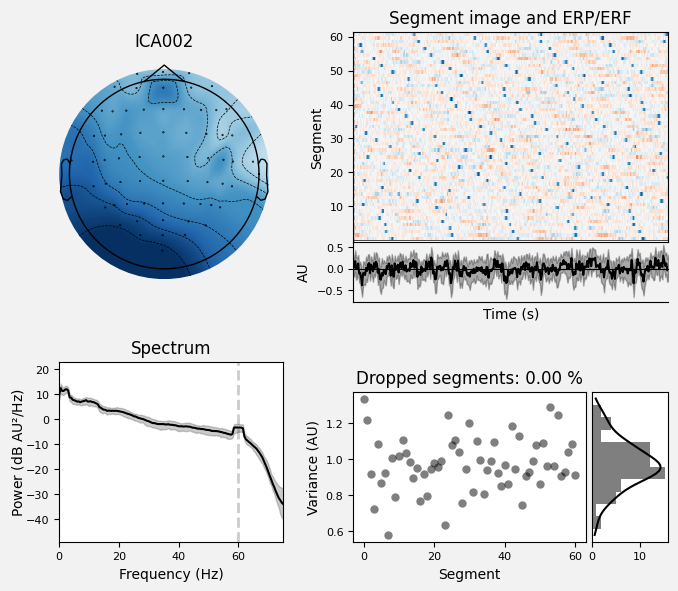 _images/train_network_eeg_1_529.png