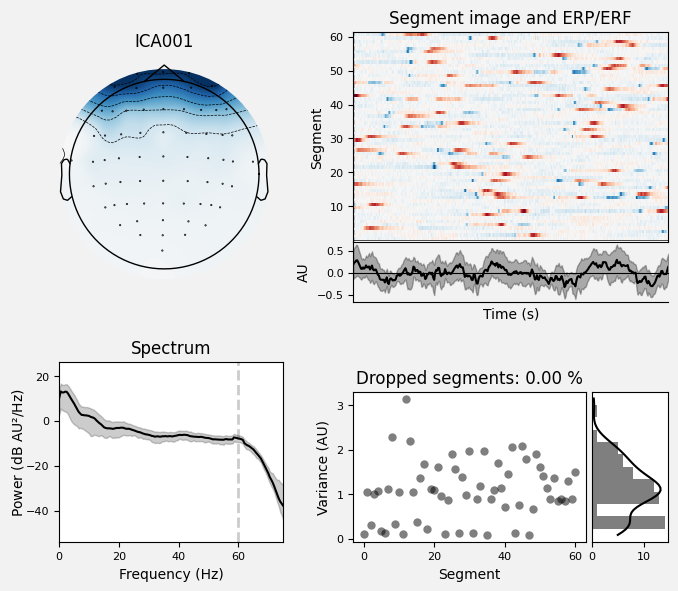 _images/train_network_eeg_1_535.png