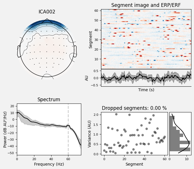 _images/train_network_eeg_1_536.png