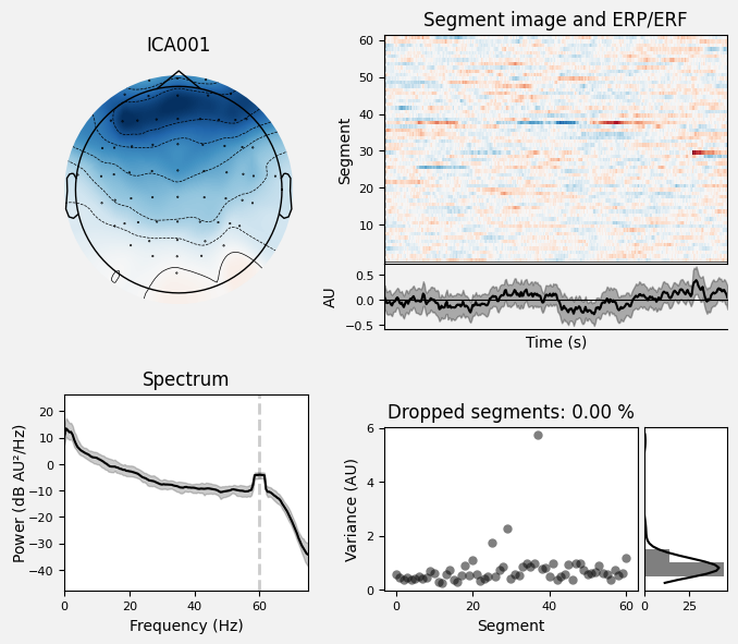 _images/train_network_eeg_1_54.png