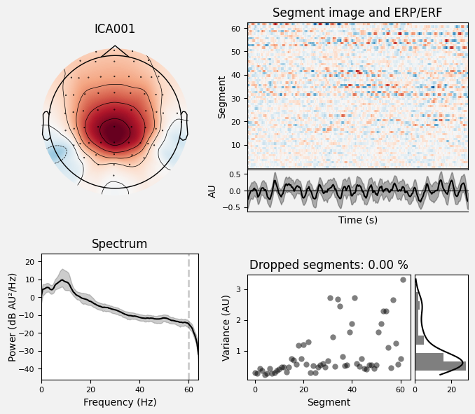_images/train_network_eeg_1_540.png