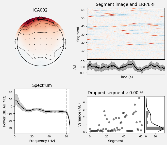 _images/train_network_eeg_1_541.png