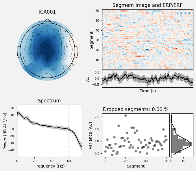 _images/train_network_eeg_1_547.png