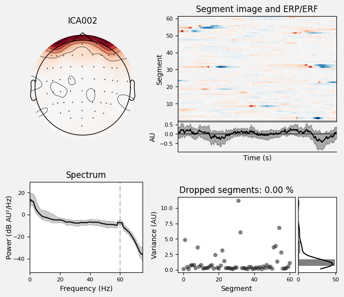 _images/train_network_eeg_1_548.png