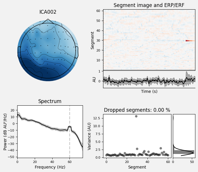 _images/train_network_eeg_1_55.png