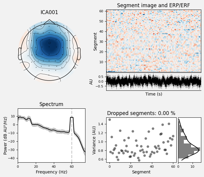 _images/train_network_eeg_1_554.png