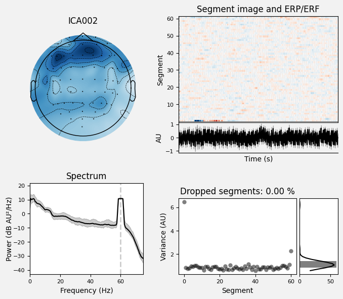 _images/train_network_eeg_1_555.png