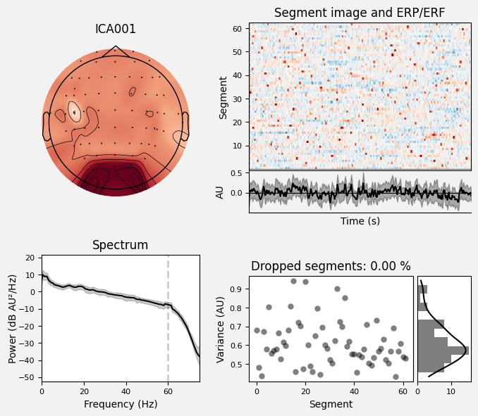 _images/train_network_eeg_1_559.png