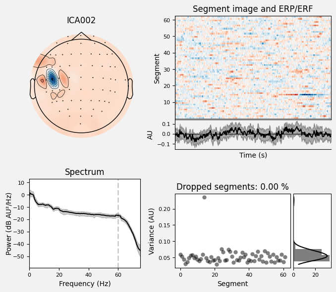 _images/train_network_eeg_1_560.png