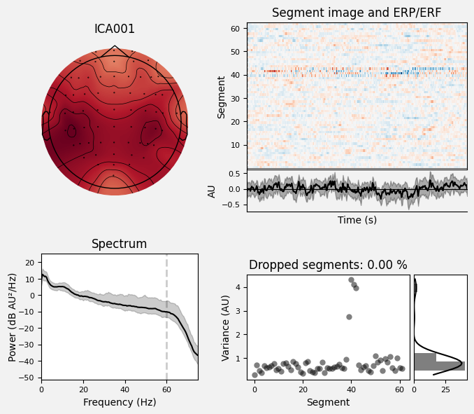 _images/train_network_eeg_1_564.png