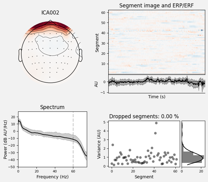 _images/train_network_eeg_1_565.png