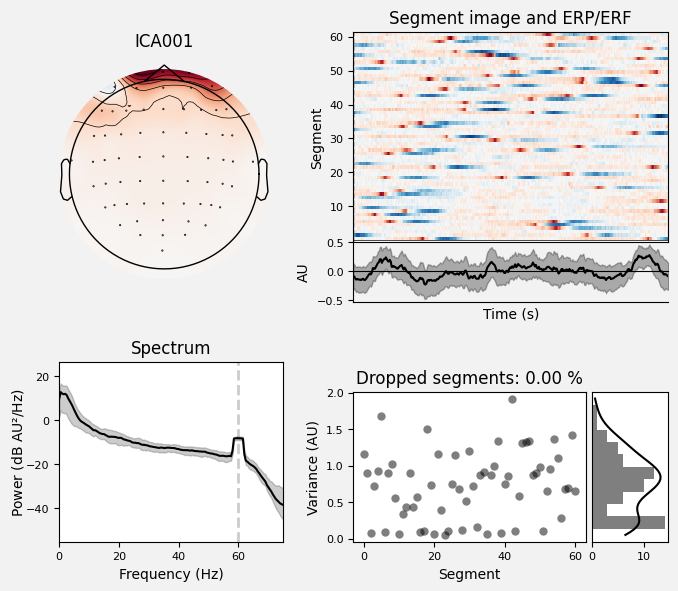 _images/train_network_eeg_1_571.png