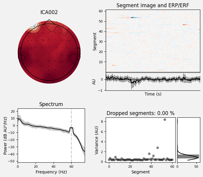 _images/train_network_eeg_1_572.png