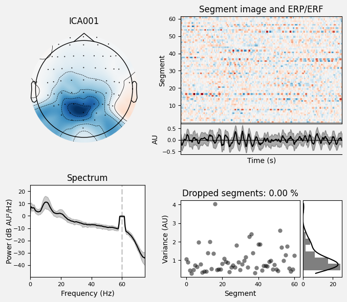 _images/train_network_eeg_1_578.png