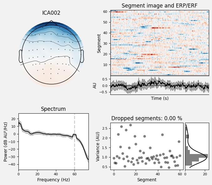 _images/train_network_eeg_1_579.png