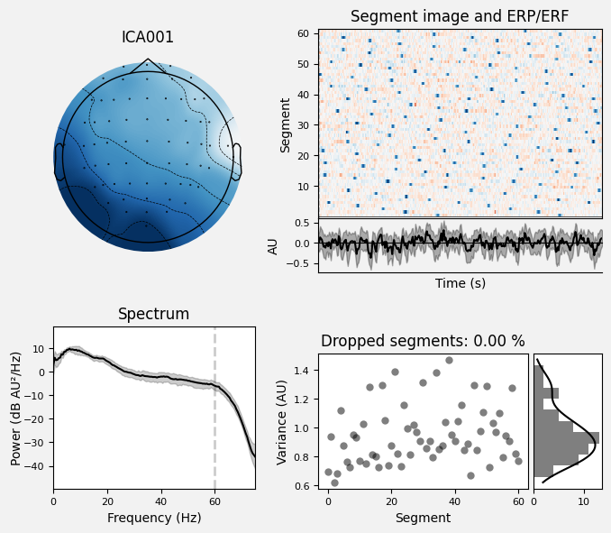 _images/train_network_eeg_1_583.png