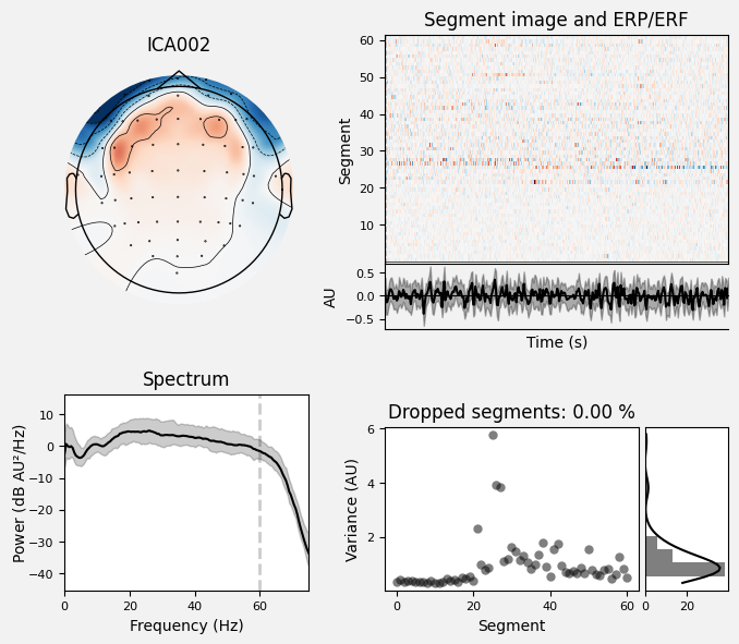 _images/train_network_eeg_1_584.png