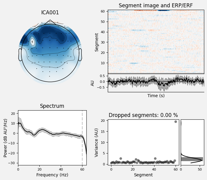 _images/train_network_eeg_1_588.png