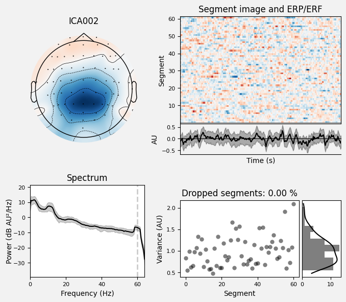 _images/train_network_eeg_1_589.png