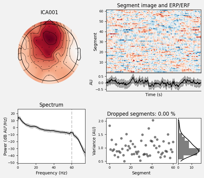 _images/train_network_eeg_1_59.png