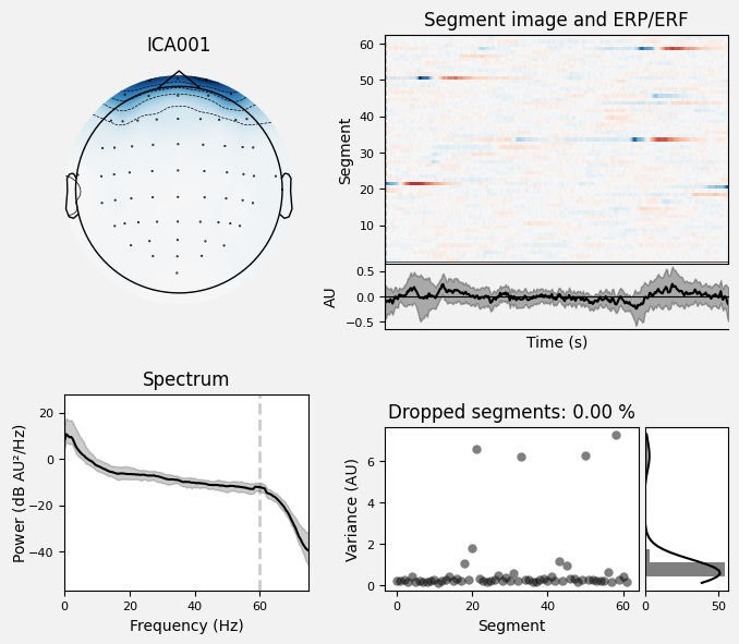 _images/train_network_eeg_1_595.png