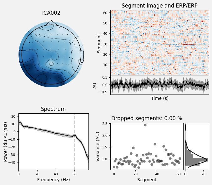 _images/train_network_eeg_1_596.png