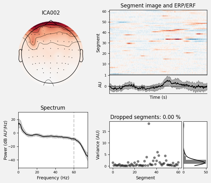 _images/train_network_eeg_1_60.png