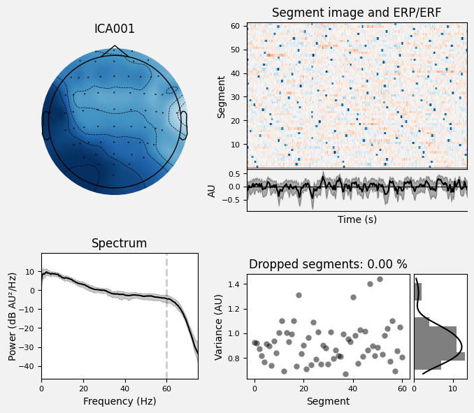_images/train_network_eeg_1_602.png