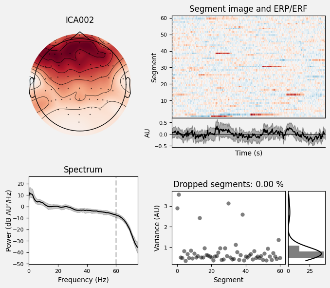 _images/train_network_eeg_1_603.png
