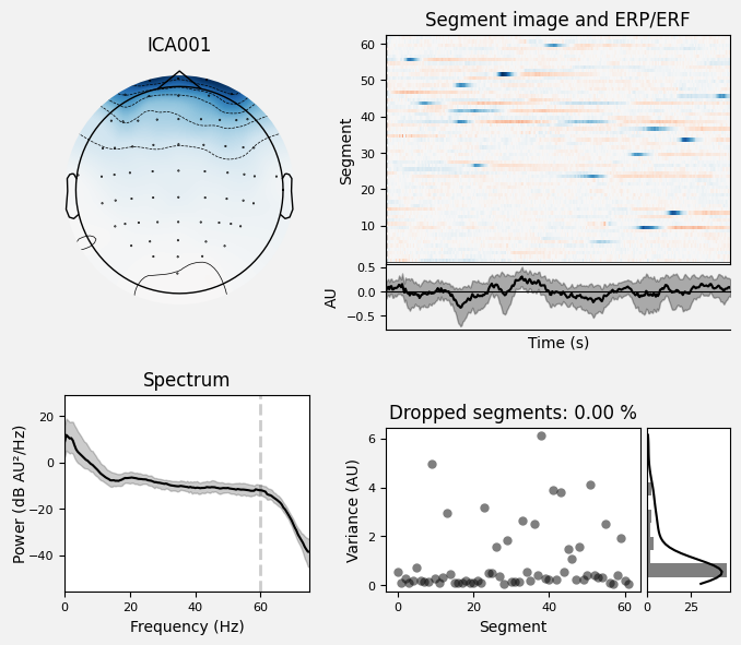 _images/train_network_eeg_1_609.png