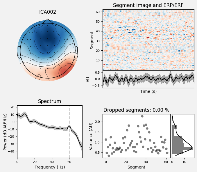 _images/train_network_eeg_1_610.png