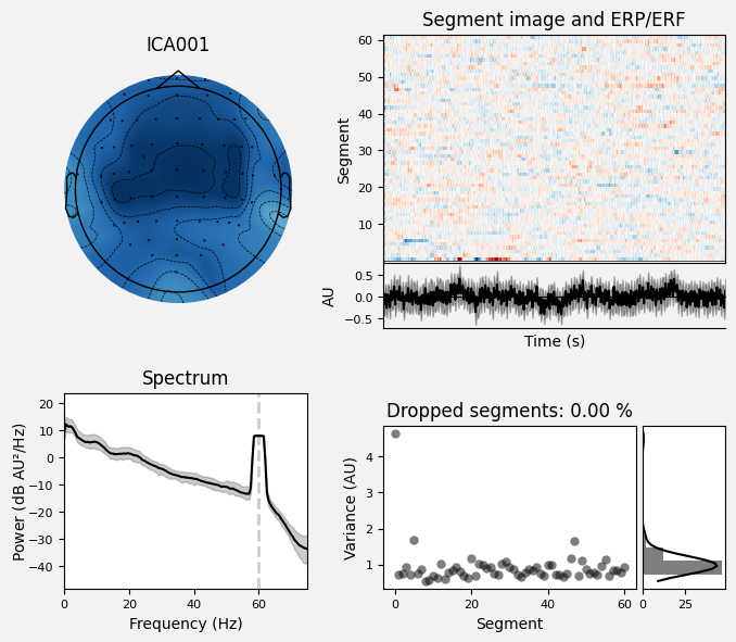 _images/train_network_eeg_1_614.png