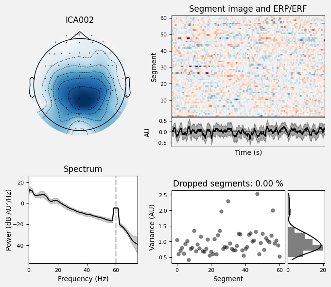 _images/train_network_eeg_1_615.png