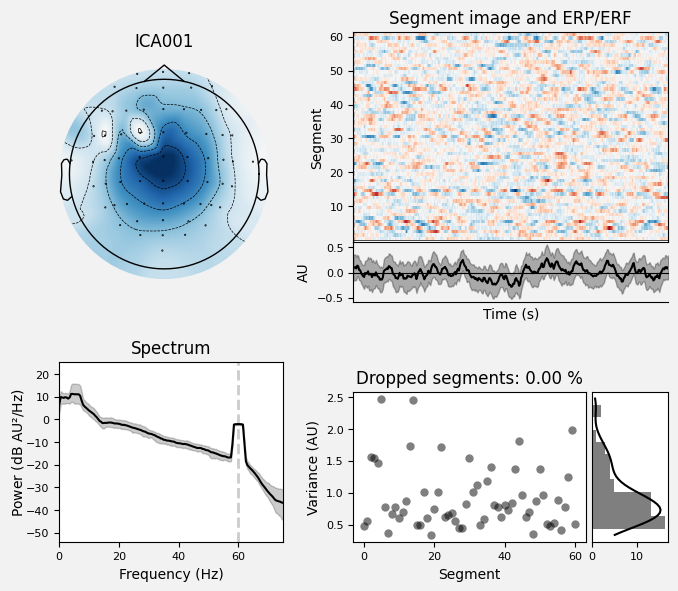 _images/train_network_eeg_1_621.png