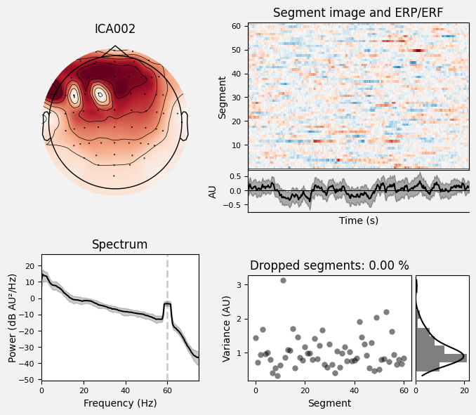 _images/train_network_eeg_1_622.png