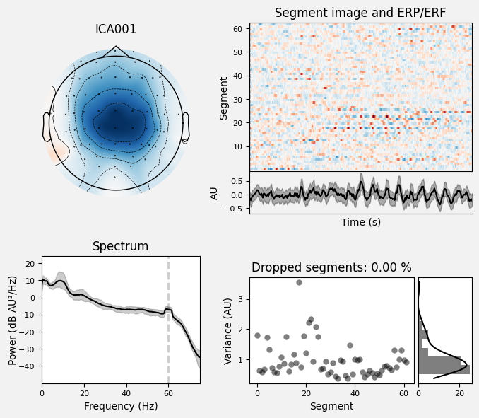 _images/train_network_eeg_1_626.png