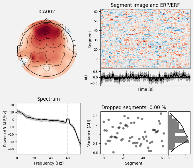_images/train_network_eeg_1_627.png