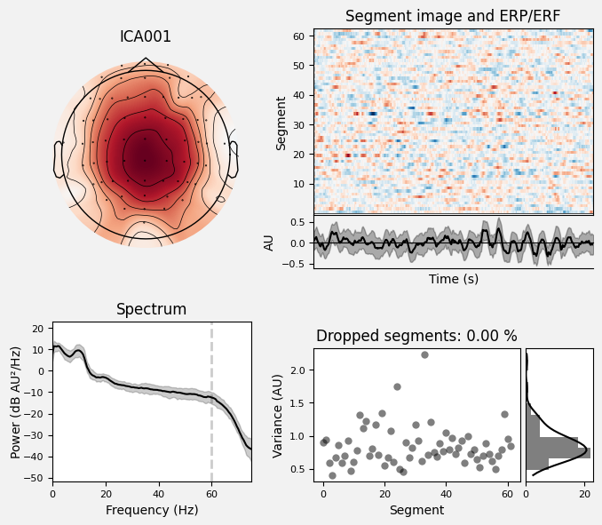_images/train_network_eeg_1_633.png