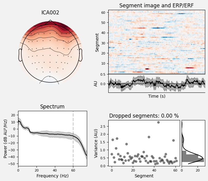 _images/train_network_eeg_1_634.png