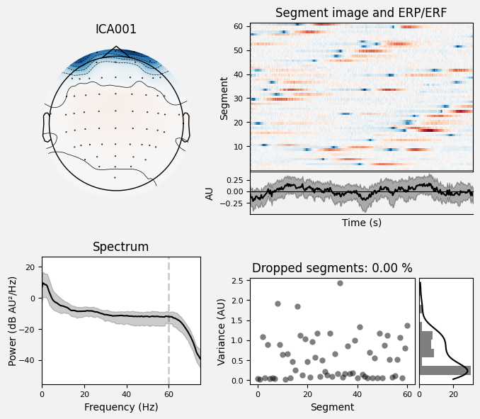 _images/train_network_eeg_1_640.png