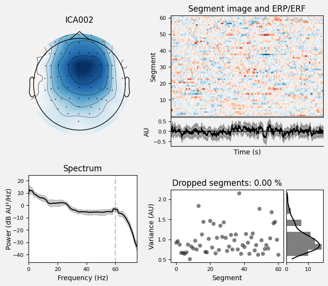 _images/train_network_eeg_1_641.png