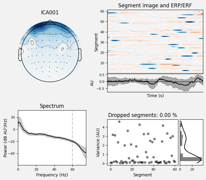 _images/train_network_eeg_1_645.png