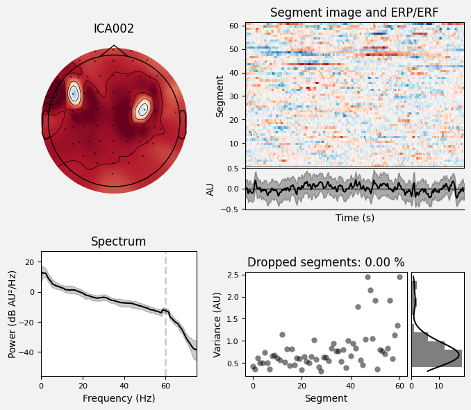 _images/train_network_eeg_1_646.png