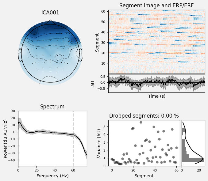 _images/train_network_eeg_1_66.png