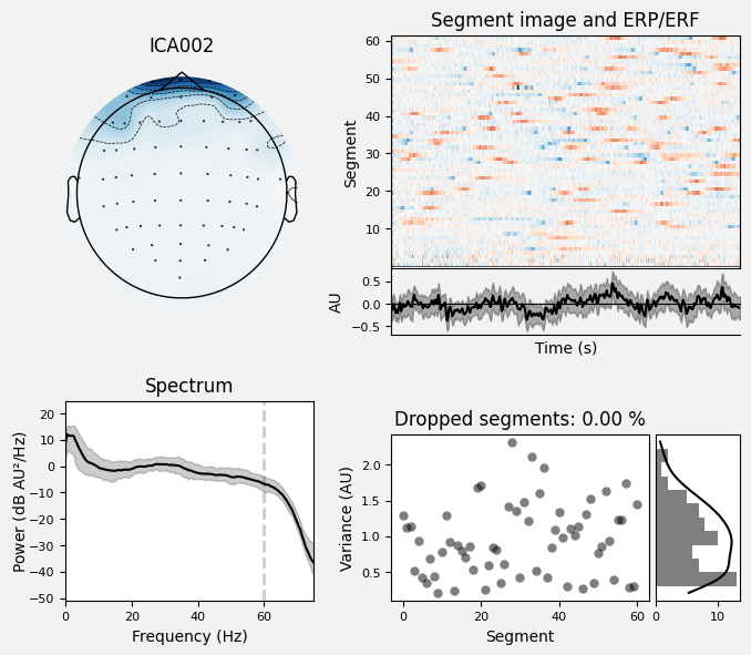 _images/train_network_eeg_1_67.png