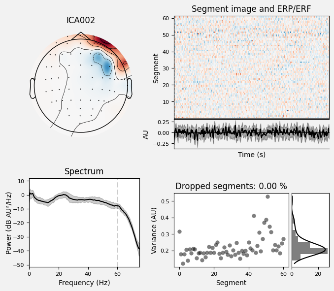 _images/train_network_eeg_1_72.png