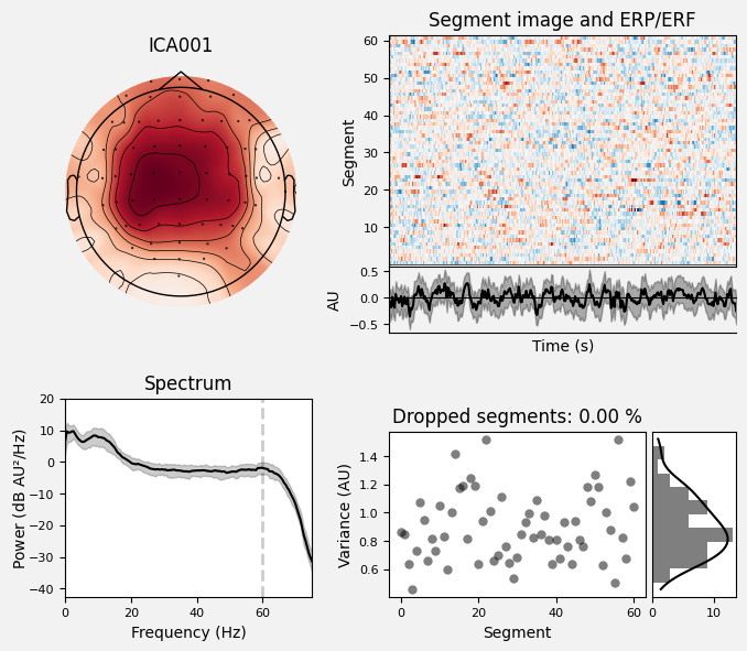 _images/train_network_eeg_1_78.png