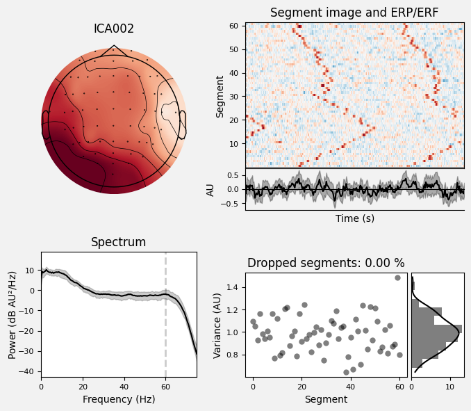 _images/train_network_eeg_1_79.png