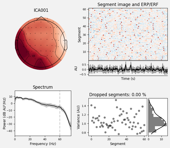 _images/train_network_eeg_1_83.png